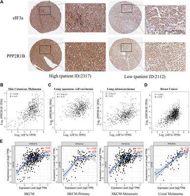 The Downregulation of eIF3a Contributes to Vemurafenib Resistance in Melanoma by Activating ERK via PPP2R1B